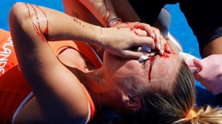 Ολυμπιακοί Αγώνες-Χόκεϊ γυναικών: Μάτωσε το πρόσωπο της Μπεργκ