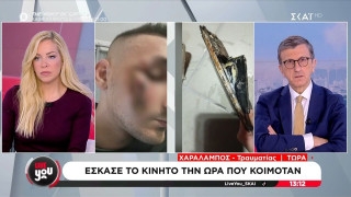 Έσκασε το κινητό ενώ κοιμόταν! - «Θα κινηθώ κατά παντός υπευθύνου - Έχει κλείσει το μισό μου μάτι»