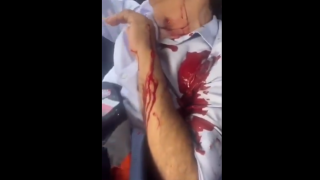 Υποψήφιος δήμαρχος «έστησε» απόπειρα δολοφονίας του και βρέθηκε στην εντατική!