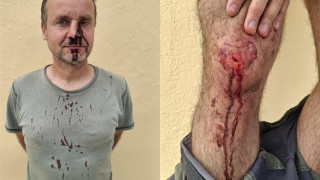 Ντροπιαστικές εικόνες στη Ζάκυνθο: Κυνηγοί ξυλοκόπησαν εθελοντές