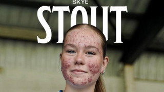 Κιλμάρνοκ: Παίκτρια έπεσε θύμα εκφοβισμού στα social media