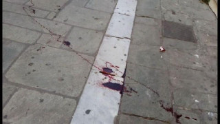 ΑΕΚτσήδες μαχαίρωσαν οπαδό του ΠΑΟΚ στο Βόλο (pics)