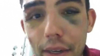 Ξυλοκοπήθηκε                άγρια οπαδός της Ατλέτικο