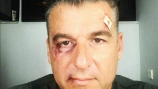 Λιάγκας: «Ευχαριστώ όσους μου ευχήθηκαν να πεθάνω, να πάθω καρκίνο»