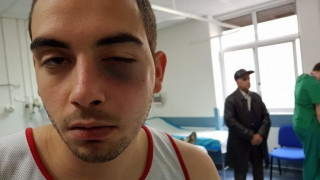 Γυμναστής γρονθοκόπησε 21χρονο επειδή διαφώνησαν για... άσκηση! (ΦΩΤΟ)