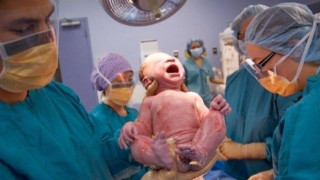 Ελληνας μαιευτήρας έπαθε έμφραγμα, αλλά συνέχισε το χειρουργείο!