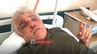 ΣΟΚ: Απίστευτη αγριότητα σε ληστεία στην Κεφαλονιά (ΒΙΝΤΕΟ)